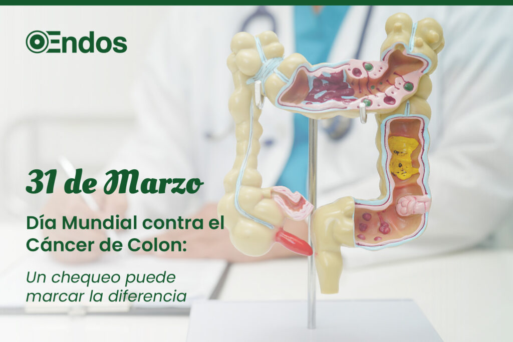 31 de Marzo, día mundial contra el cáncer de colon. Endos Medicina