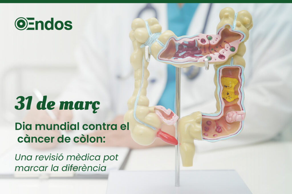 Día mundial del cáncer de colon